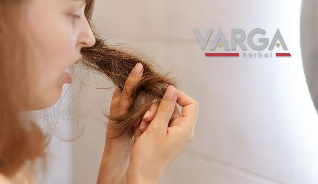 változókori hajhullás